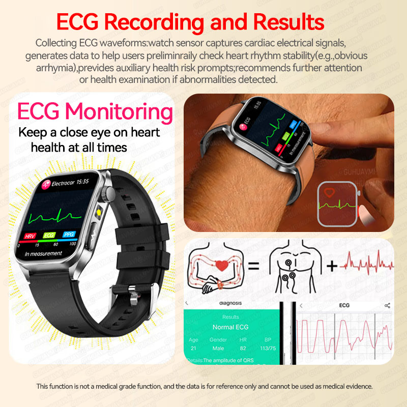 Novo Smartwatch 2026 com Três  - Industrial Laser Training avaliação e preço